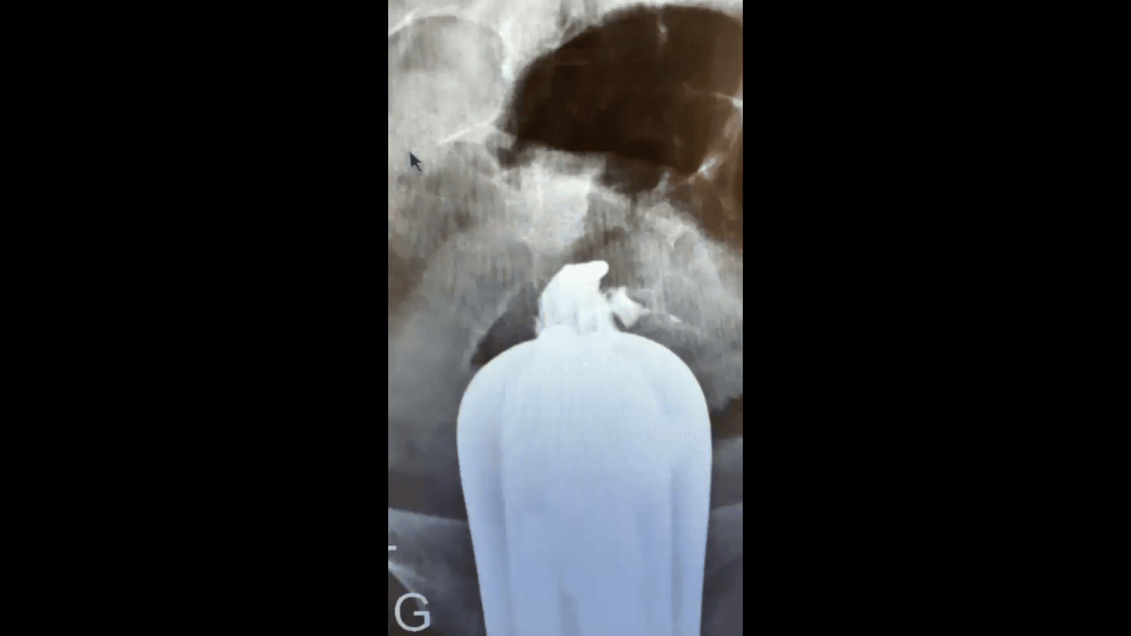 Video 1B
