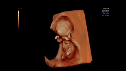 Video 1