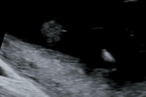 Video 2