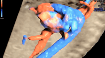 Video 3