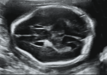 Video 7