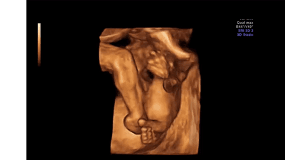 Video 9